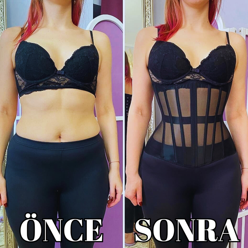 Yeyila® Görünmez Toparlayıcı Korse
